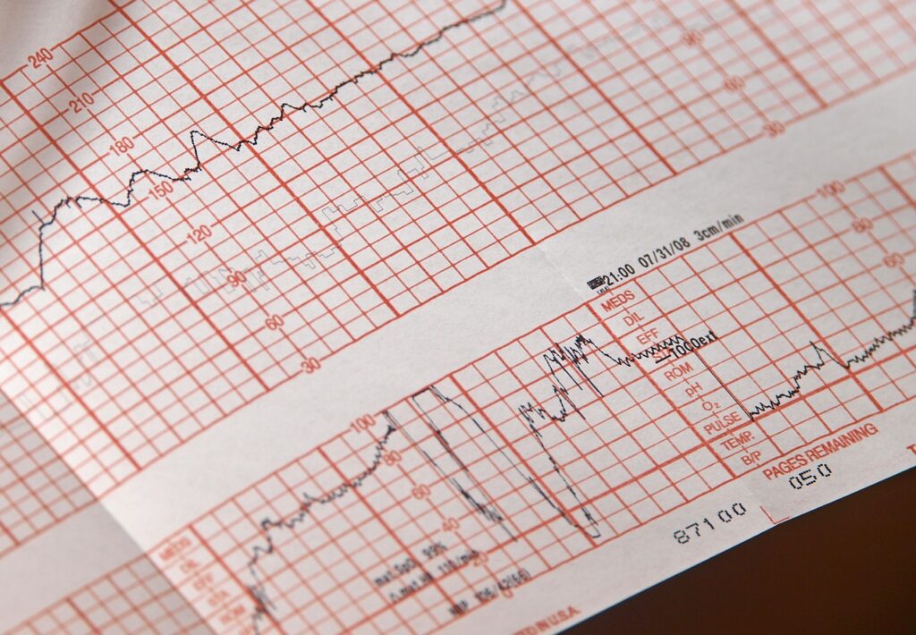 EKG graph paper
